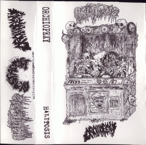 Orchiopexy : Orchiopexy - Halitosis